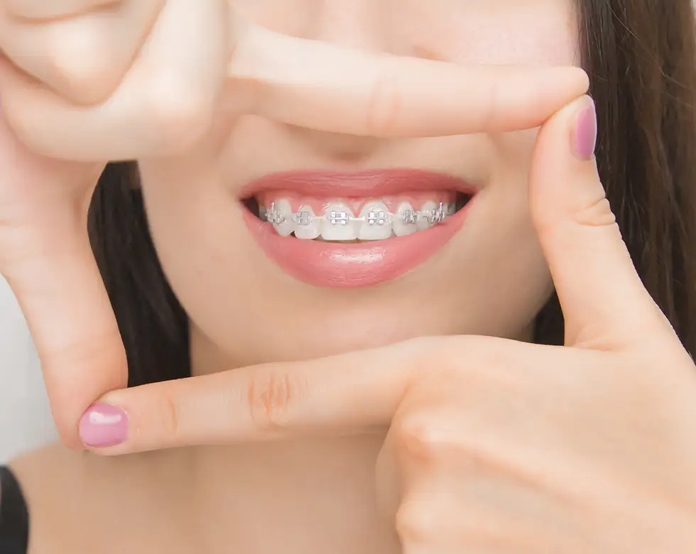 Ortodonzia d’ eccellenza per il tuo sorriso - Olbia Dental Studio - Estetica Dentale e Implantologia Avanzata