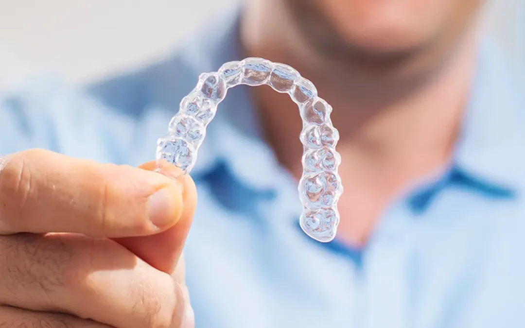 Ortodonzia trasparente a Olbia: allineatori trasparenti per sorridere senza apparecchio