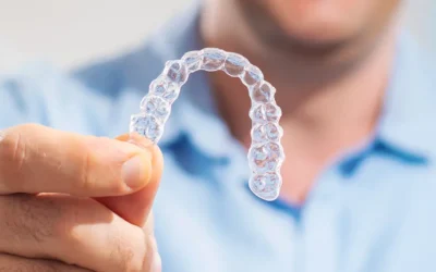 Ortodonzia trasparente a Olbia: allineatori trasparenti per sorridere senza apparecchio