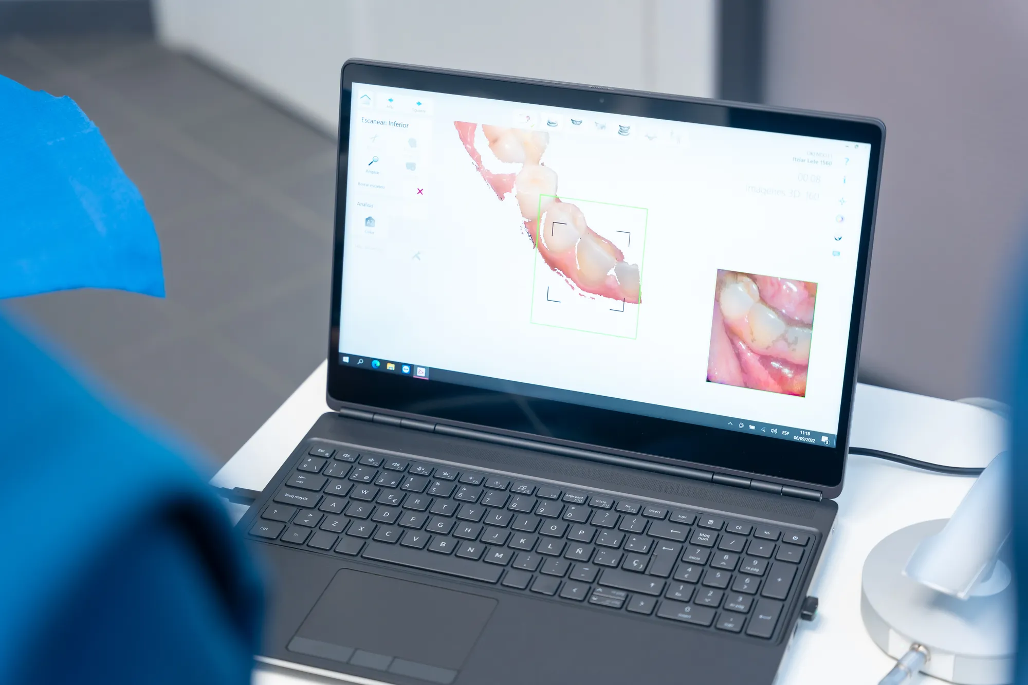 Sedazione cosciente - Olbia Dental Studio