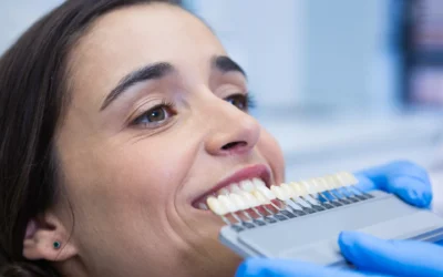 Faccette dentali a Olbia: cosa sono, quanto durano e a chi servono