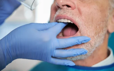 Parodontite e impianti: cosa succede se non curi le gengive prima